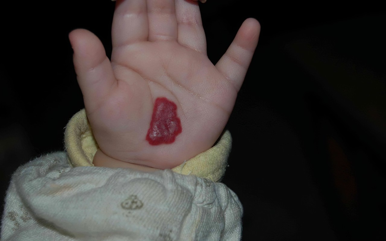 R-C